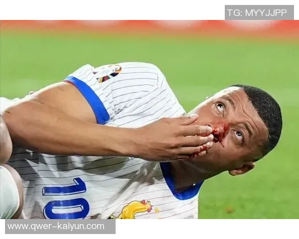 姆巴佩确认继续为法国国家队效力不会回马德里养伤